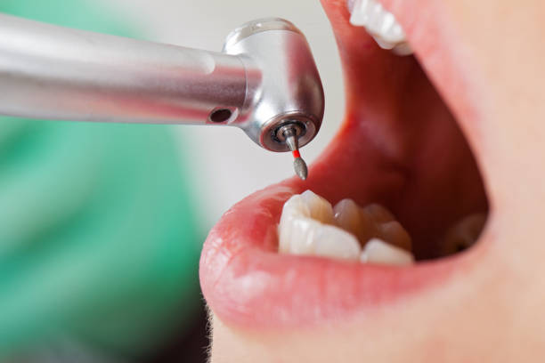 Best Walk-In Emergency Dental Services in Ashland, VA